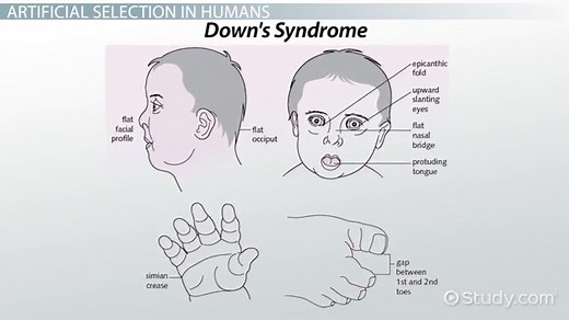 Genetic Selection Types, Impacts & Arguments