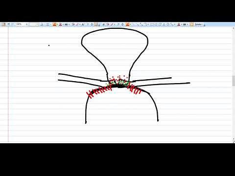 Fothergills Repair ; Manchester Surgery