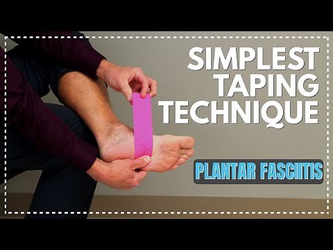 Simplest Taping Technique EVER for Plantar Fasciitis