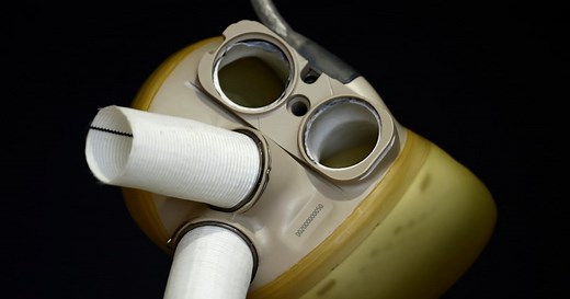 CARMAT announces the first commercial implant of its Aeson artificial heart